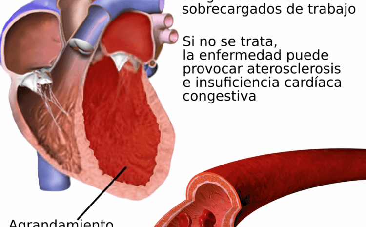 Hipertensión arterial y la Diabetes